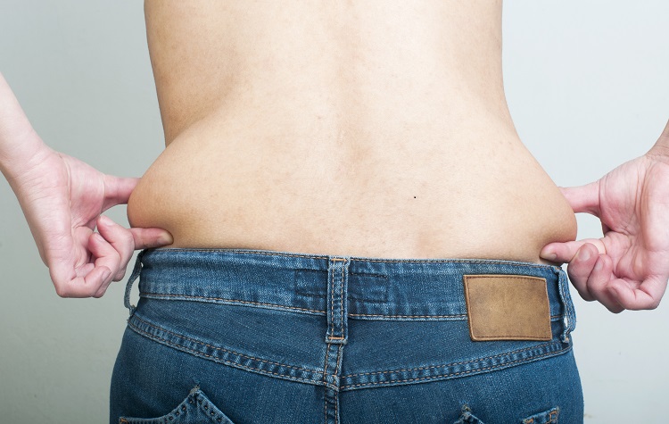 Muffin-Top-Flanks-PureCryo-Fat-Freezing-Sussex-Laser-Lipo